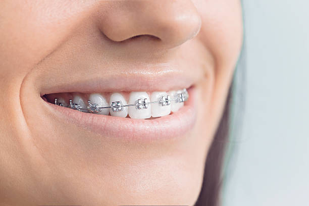 Best Dental Inlays and Onlays  in Hiram, OH
